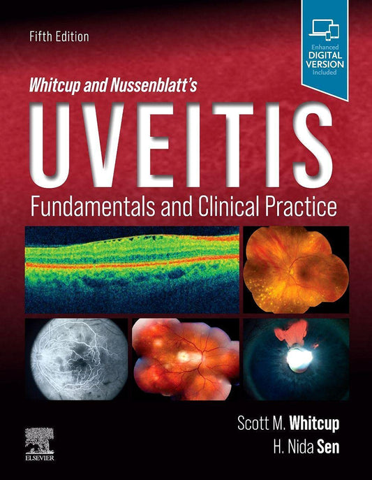Whitcup and Nussenblatt's Uveitis: Fundamentals and Clinical Practice 5th Edition