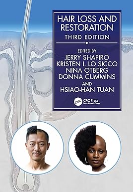 Hair Loss and Restoration 3rd Edition