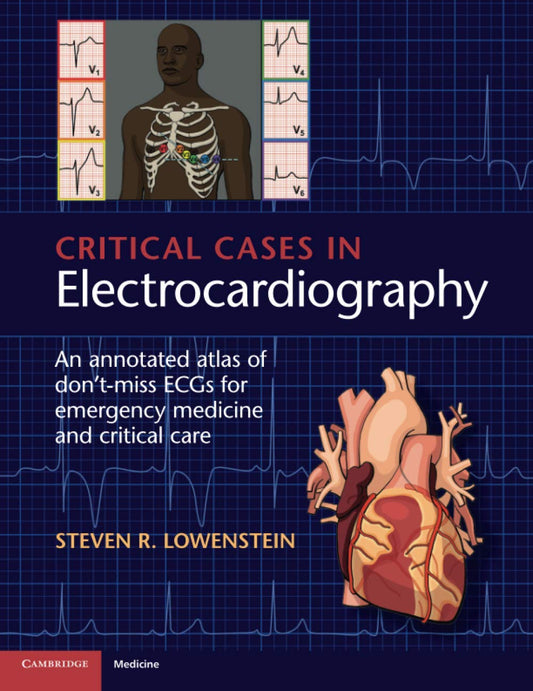 Critical Cases in Electrocardiography: An Annotated Atlas of Don't-Miss ECGs for Emergency Medicine and Critical Care 1st Edition