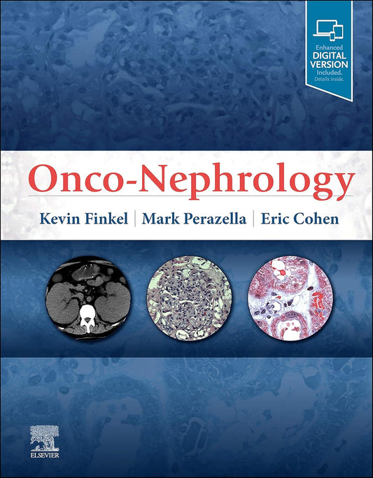 Onco-Nephrology, 1st Edition