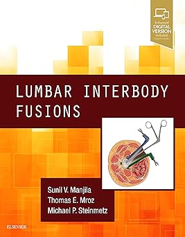 Lumbar Interbody Fusions 1st Edition