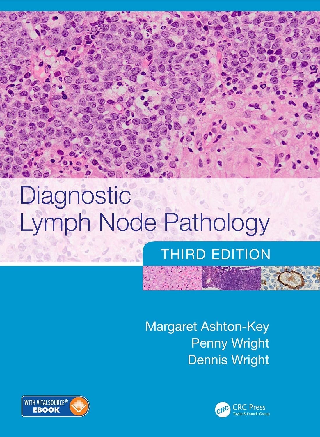 Diagnostic Lymph Node Pathology, 3rd Edition