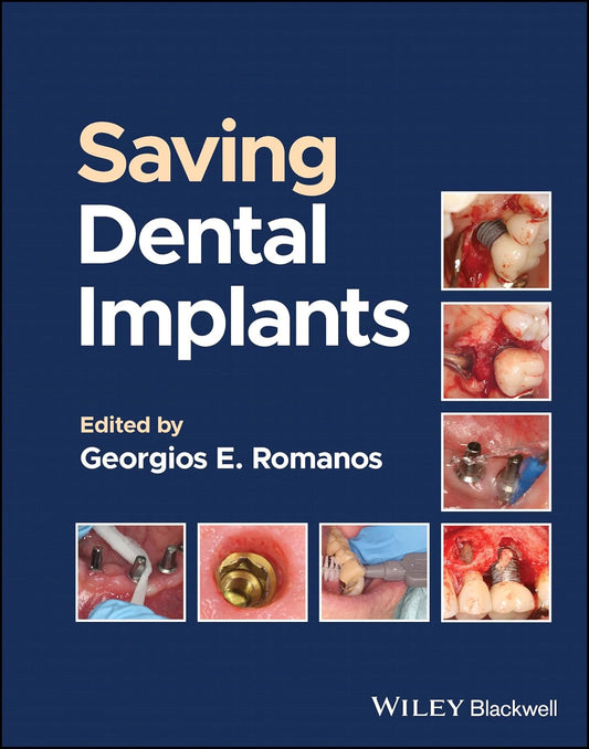 Saving Dental Implants 1st Edition