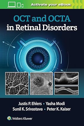 OCT and OCTA in Retinal Disorders 1st Edition