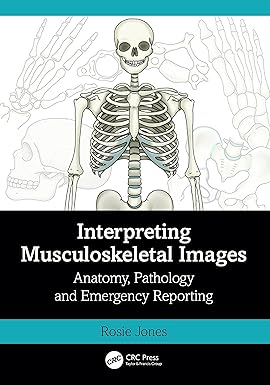 Interpreting Musculoskeletal Images: Anatomy, Pathology and Emergency Reporting