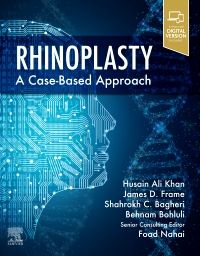 Rhinoplasty, 1st Edition