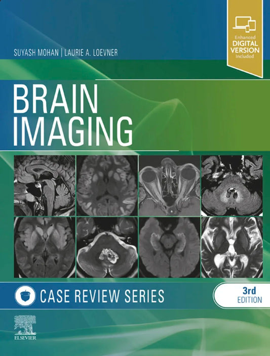 Brain Imaging- Case Review Series, 3rd Edition