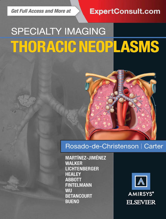 Specialty Imaging: Thoracic Neoplasms E-Book 1st Edition, Kindle Edition