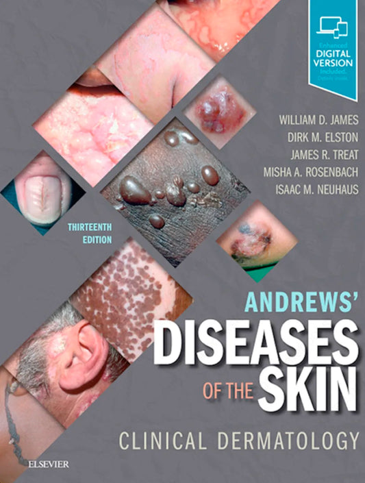 Andrews' Diseases of the Skin, 13th Edition