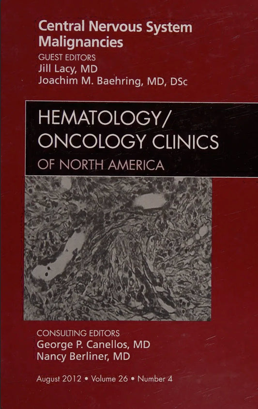 Central Nervous System Malignancies, An Issue of Hematology/Oncology Clinics of North America, 1st Edition