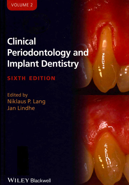 Clinical Periodontology and Implant Dentistry 6th Edition, Volume 2