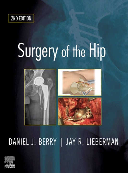 Surgery of the Hip: Expert Consult - 2nd Edition