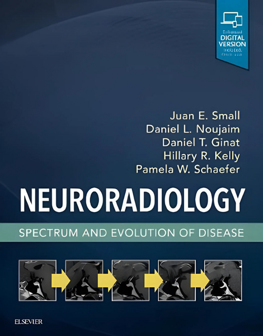 Neuroradiology: Spectrum and Evolution of Disease 1st Edition