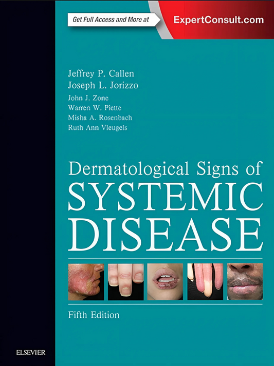 Dermatological Signs of Systemic Disease, 5th Edition